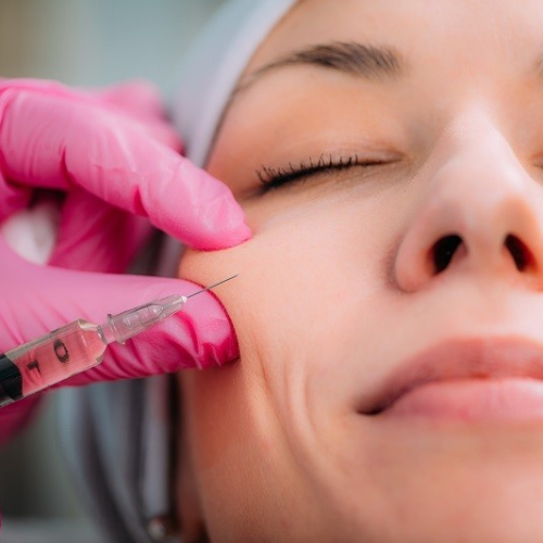 Woman receiving volume enhancement treatment at StarBella Spa” or “Before and after volume enhancement results.”